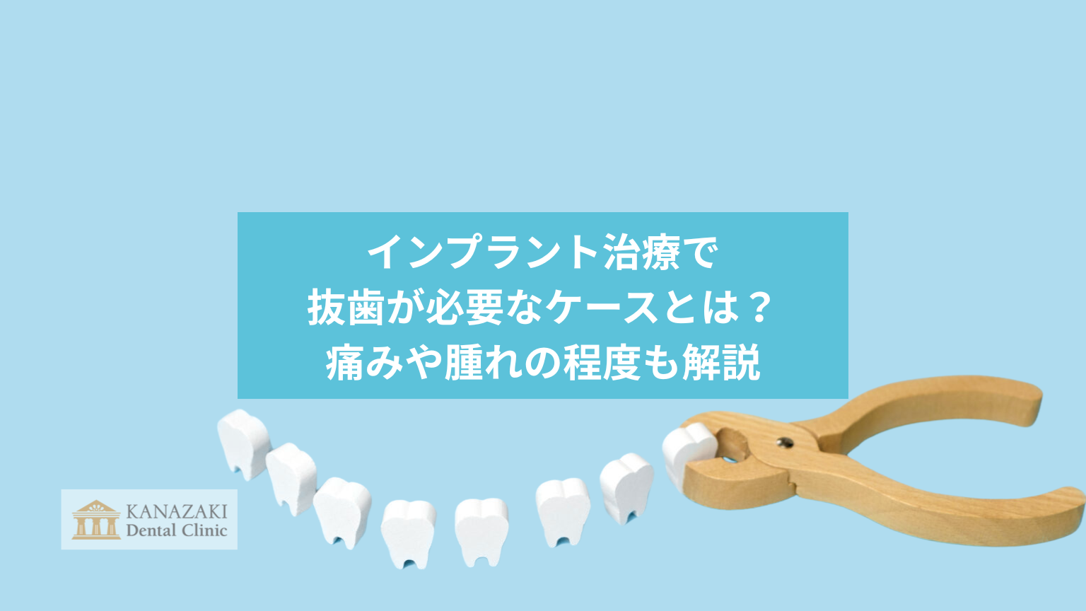 インプラント治療で抜歯が必要なケースとは?痛みや腫れの程度も解説のアイキャッチ