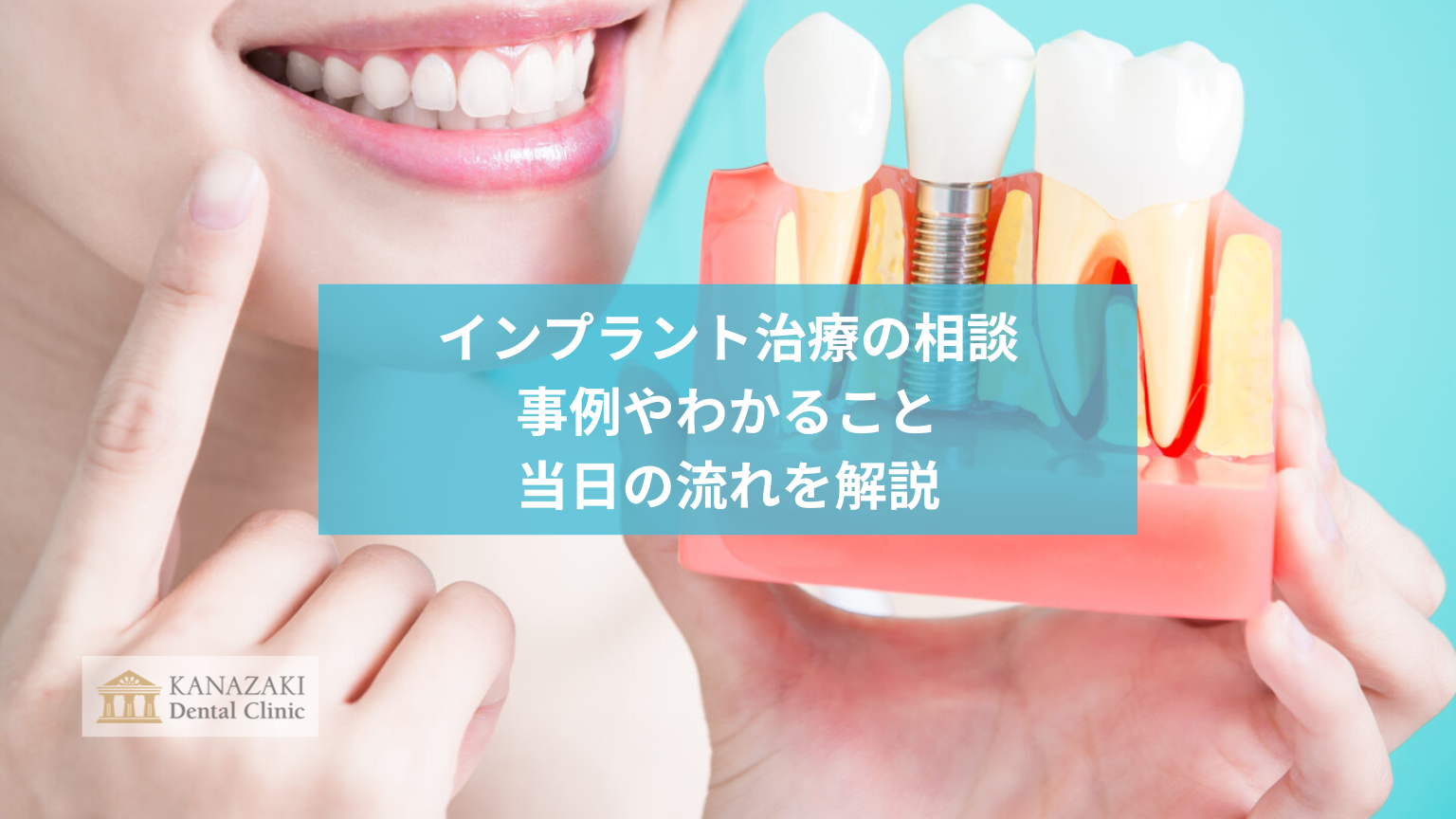 インプラント治療の相談|事例やわかること、当日の流れを解説のアイキャッチ