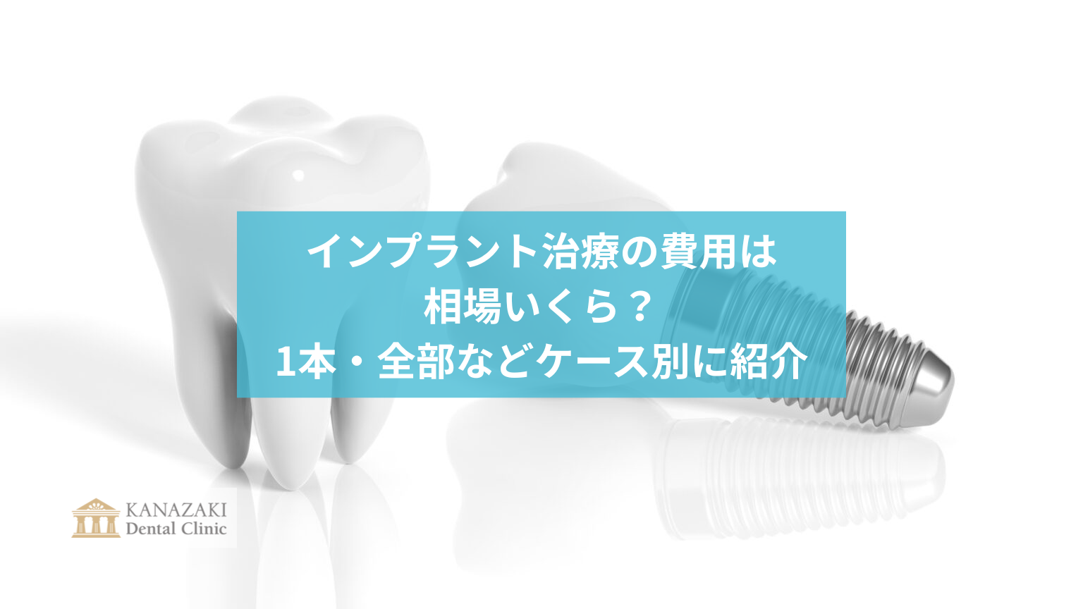 インプラント治療の費用は相場いくら?1本・全部などケース別に紹介のアイキャッチ